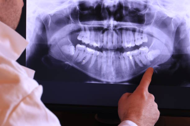 Best Urgent Care for Lost Fillings or Crowns in Avilla, AR