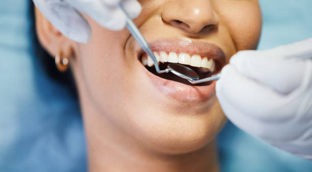 Best Emergency Treatment for Dental Infections or Abscesses in Avilla, AR